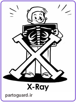 اشعه ایکس یا ایکس ری (X RAY) چیست ؟