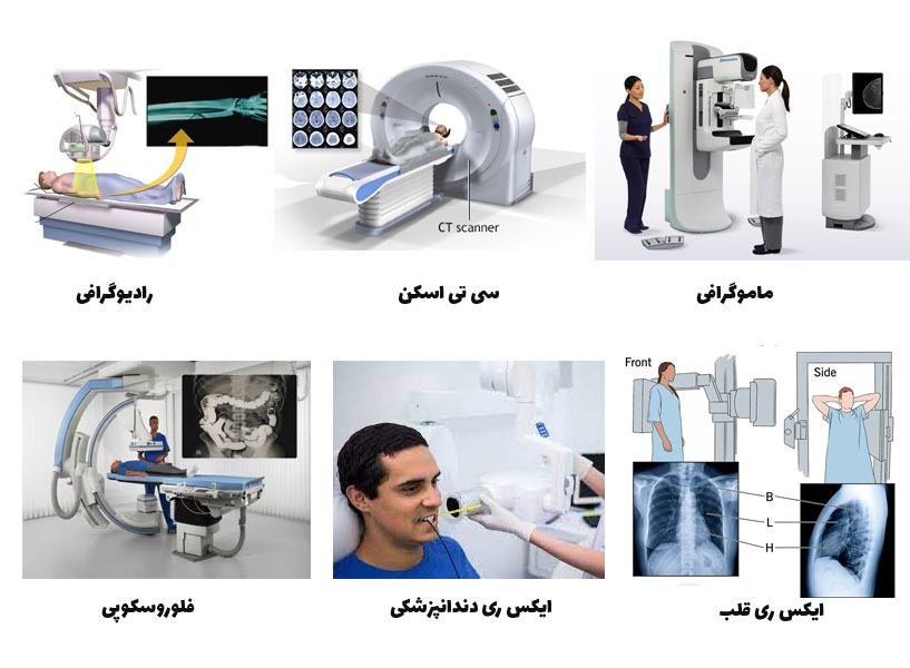 انواع دستگاه ایکس ری